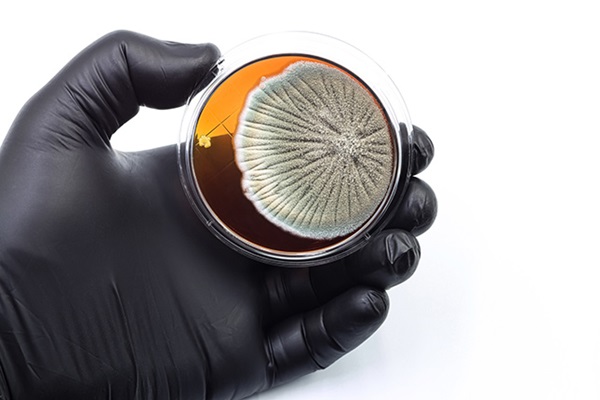 culture-champignons-mycoses